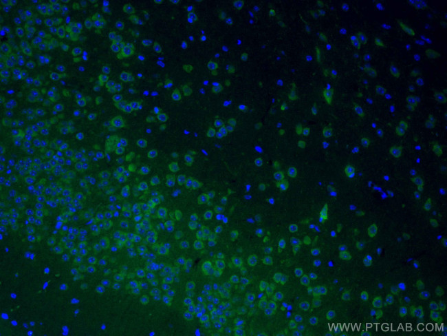 GRIA1 Antibody in Immunohistochemistry (Paraffin) (IHC (P))