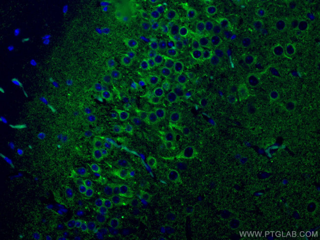 P2RY1 Antibody in Immunohistochemistry (Paraffin) (IHC (P))