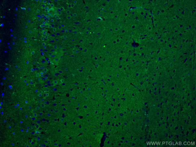 P2RY1 Antibody in Immunohistochemistry (Paraffin) (IHC (P))