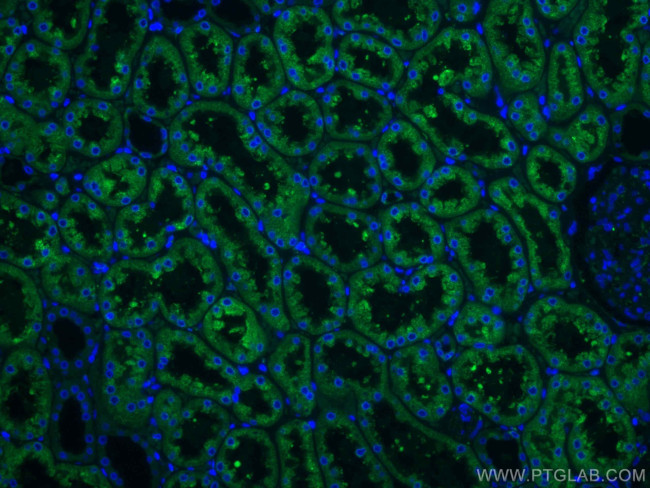 ERP29 Antibody in Immunohistochemistry (Paraffin) (IHC (P))