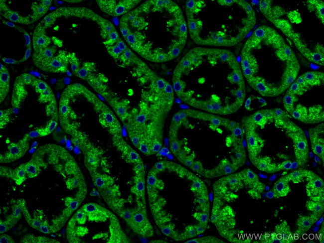 ERP29 Antibody in Immunohistochemistry (Paraffin) (IHC (P))