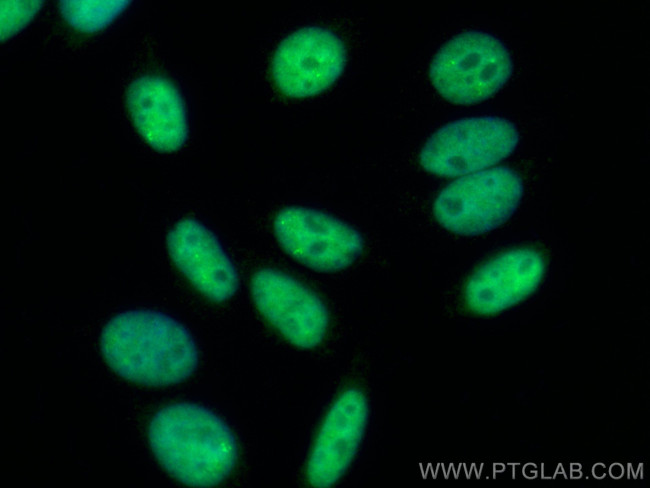 NF45 Antibody in Immunocytochemistry (ICC/IF)