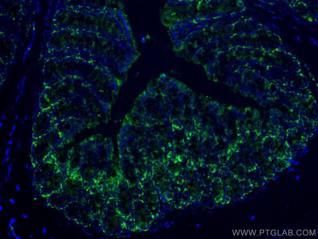 FABP2 Antibody in Immunohistochemistry (Paraffin) (IHC (P))