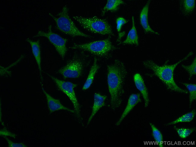 EPRS Antibody in Immunocytochemistry (ICC/IF)