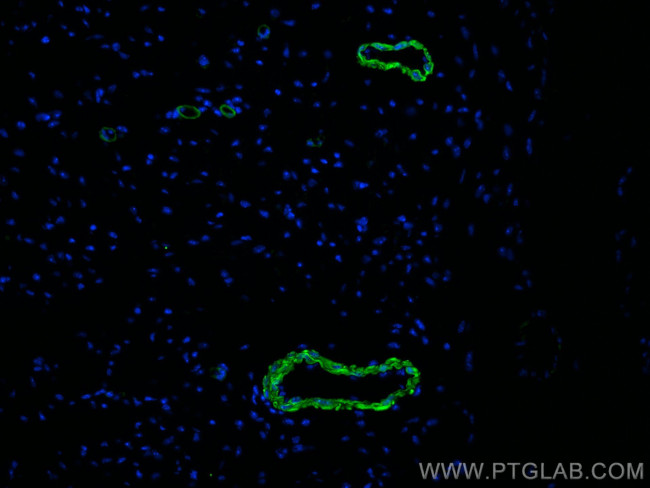 smooth muscle actin Antibody in Immunohistochemistry (Paraffin) (IHC (P))