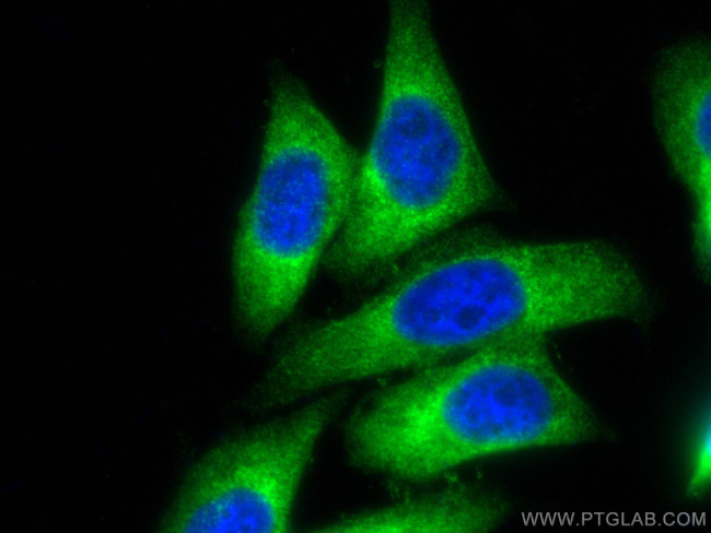 MARS Antibody in Immunocytochemistry (ICC/IF)