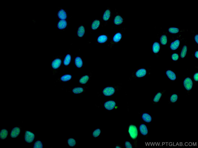 EIF4A3 Antibody in Immunocytochemistry (ICC/IF)