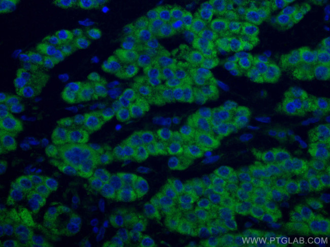 ACADM Antibody in Immunohistochemistry (Paraffin) (IHC (P))