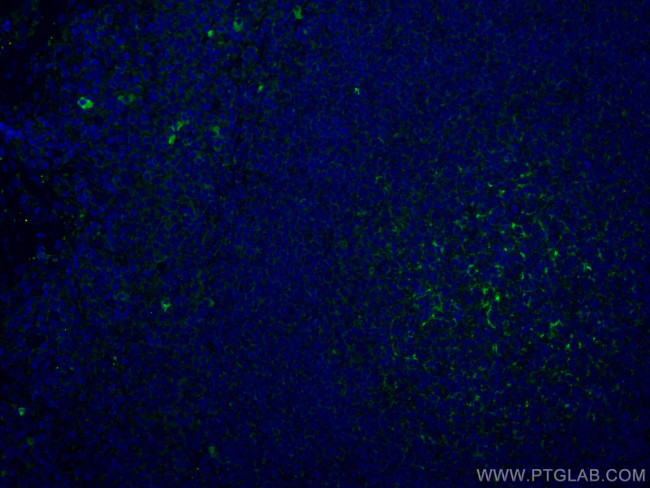 CD70 Antibody in Immunohistochemistry (Paraffin) (IHC (P))