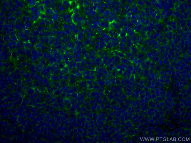 CD70 Antibody in Immunohistochemistry (Paraffin) (IHC (P))