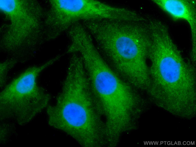 VASH2 Antibody in Immunocytochemistry (ICC/IF)