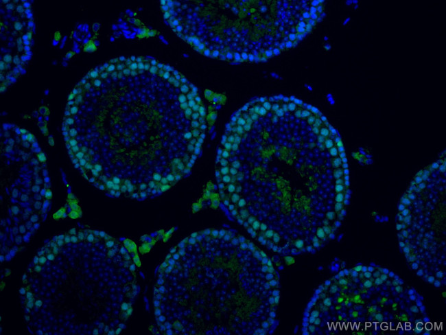 EED Antibody in Immunohistochemistry (Paraffin) (IHC (P))