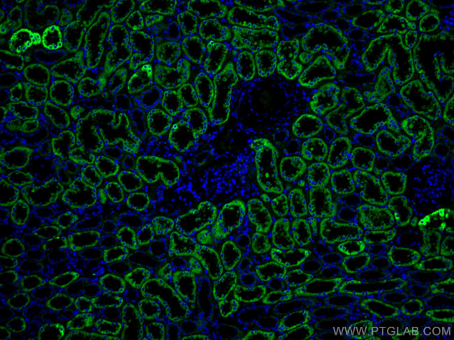 AIF Antibody in Immunohistochemistry (Paraffin) (IHC (P))