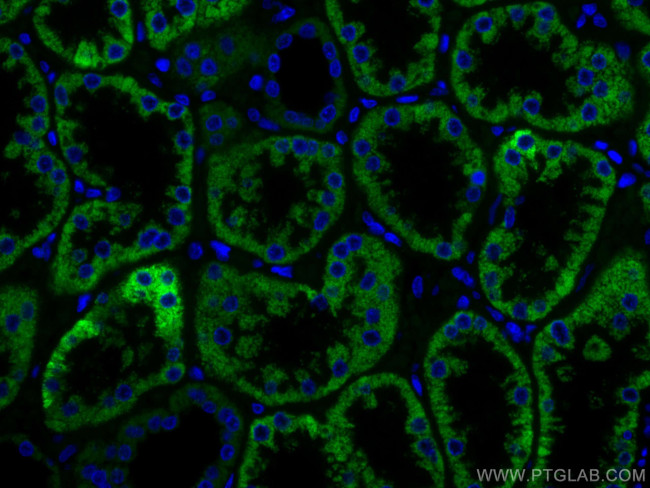 AIF Antibody in Immunohistochemistry (Paraffin) (IHC (P))