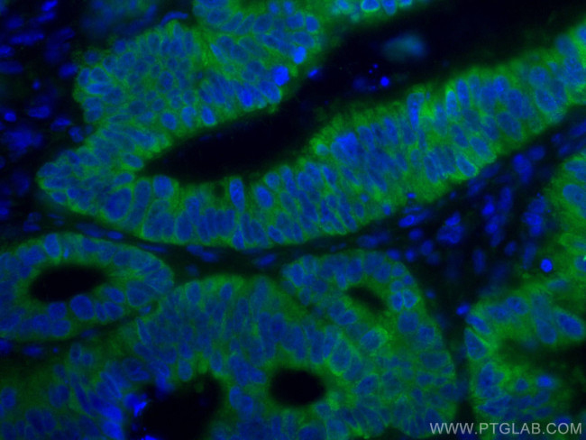 CNOT4 Antibody in Immunohistochemistry (Paraffin) (IHC (P))