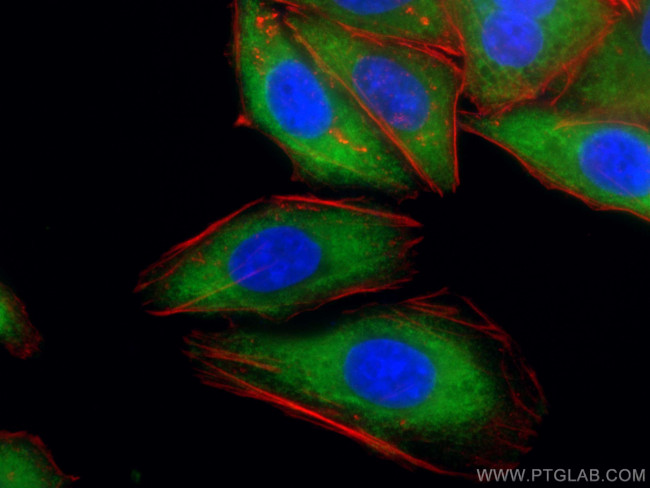 LARP1 Antibody in Immunocytochemistry (ICC/IF)