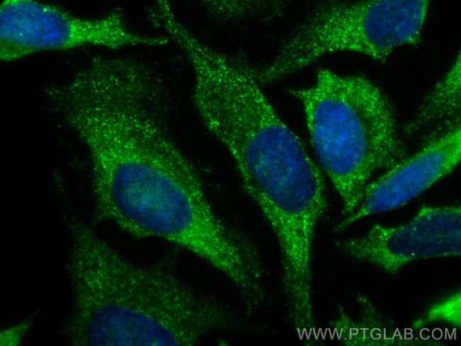 FXR1 Antibody in Immunocytochemistry (ICC/IF)