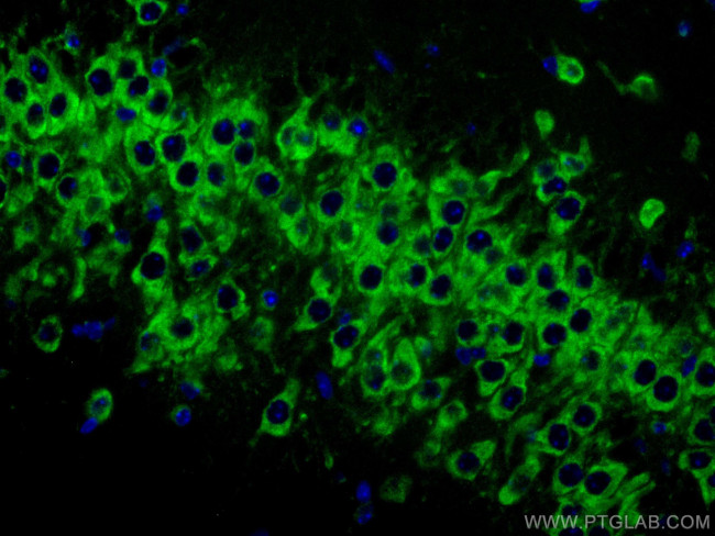 FXR1 Antibody in Immunohistochemistry (Paraffin) (IHC (P))