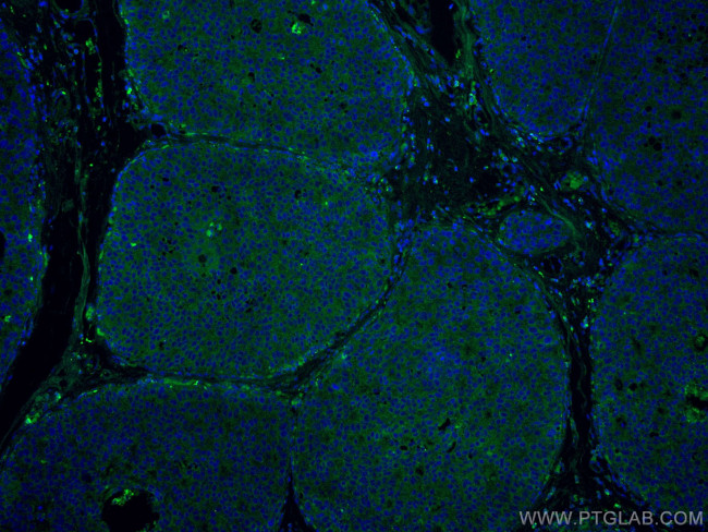 DAPK1 Antibody in Immunohistochemistry (Paraffin) (IHC (P))