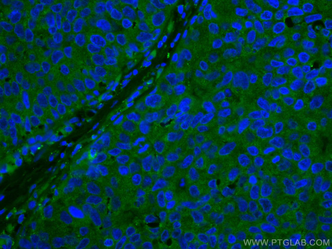 DAPK1 Antibody in Immunohistochemistry (Paraffin) (IHC (P))