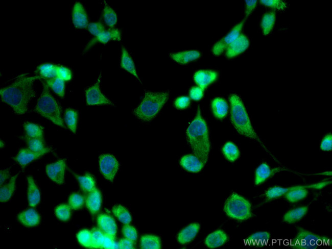 CAPNS1 Antibody in Immunocytochemistry (ICC/IF)