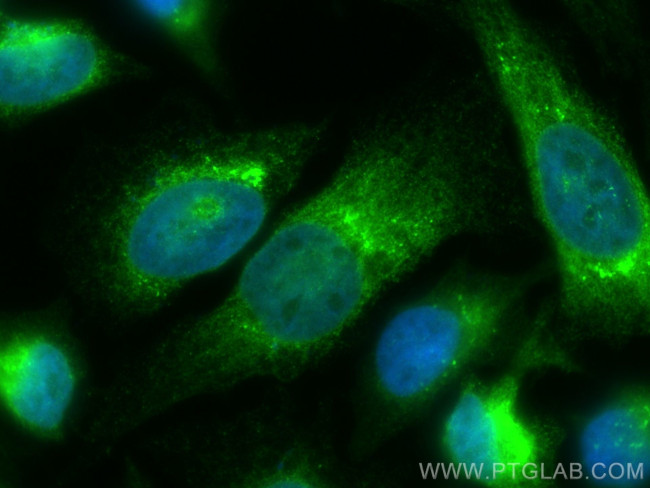 HSP47 Antibody in Immunocytochemistry (ICC/IF)