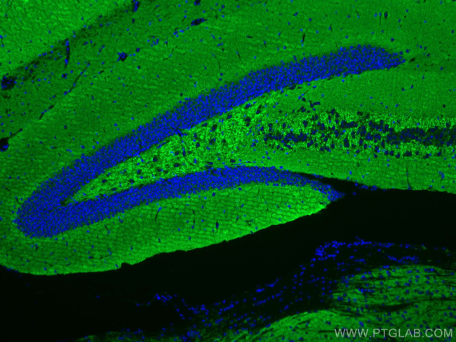 Synaptophysin Antibody in Immunohistochemistry (Paraffin) (IHC (P))