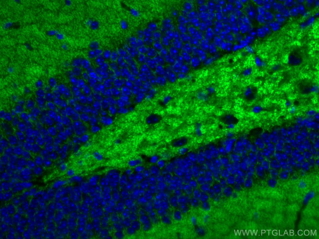 Synaptophysin Antibody in Immunohistochemistry (Paraffin) (IHC (P))