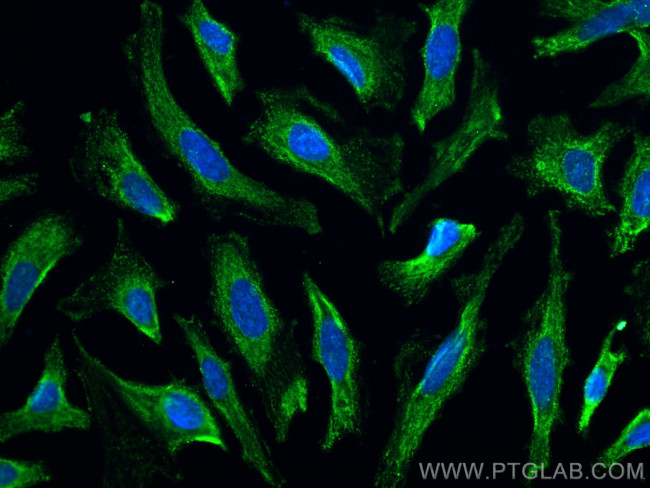 KBTBD2 Antibody in Immunocytochemistry (ICC/IF)