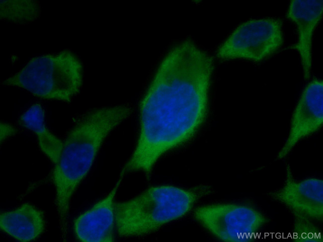 AlaRS Antibody in Immunocytochemistry (ICC/IF)