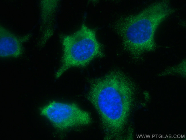 SCAMP3 Antibody in Immunocytochemistry (ICC/IF)