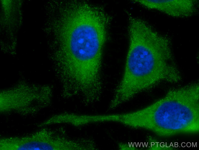 LARS Antibody in Immunocytochemistry (ICC/IF)