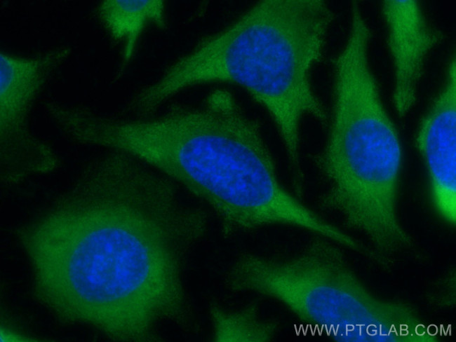 PAIP1 Antibody in Immunocytochemistry (ICC/IF)