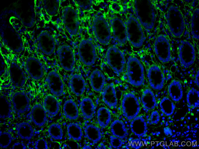 Collagen Type III Antibody in Immunohistochemistry (Paraffin) (IHC (P))