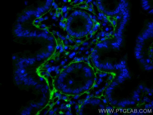 Collagen Type III Antibody in Immunohistochemistry (Paraffin) (IHC (P))