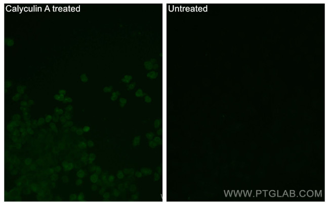 Phospho-STK11 (Thr189) Antibody in Immunocytochemistry (ICC/IF)