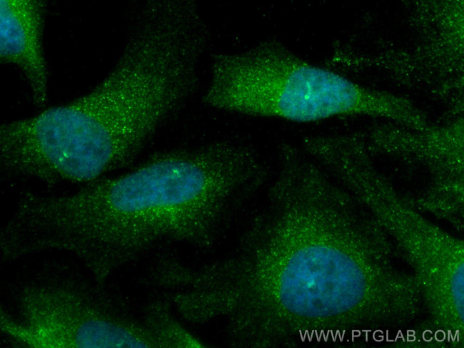 MAP2K3 Antibody in Immunocytochemistry (ICC/IF)