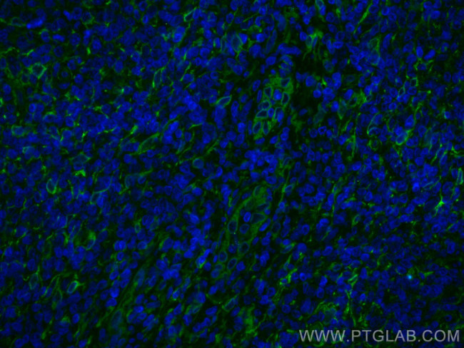 TMEM173/STING Antibody in Immunohistochemistry (Paraffin) (IHC (P))