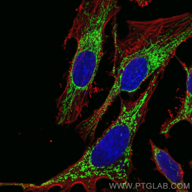 C1QBP Antibody in Immunocytochemistry (ICC/IF)