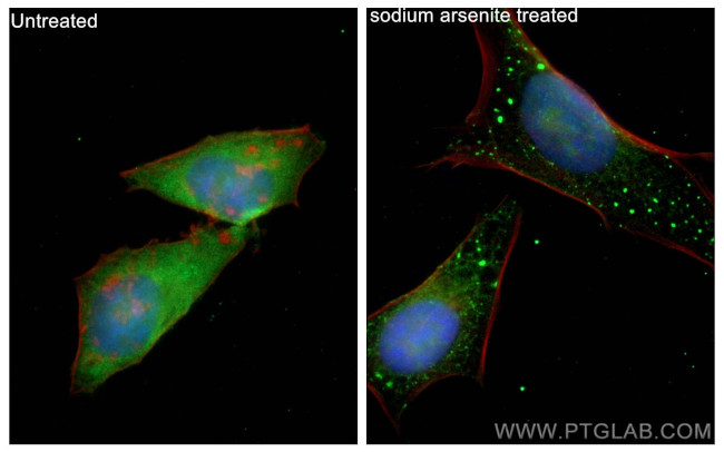 G3BP1 Antibody in Immunocytochemistry (ICC/IF)