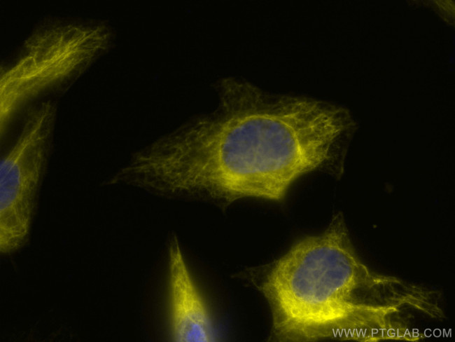 Cytokeratin 18 Antibody in Immunocytochemistry (ICC/IF)