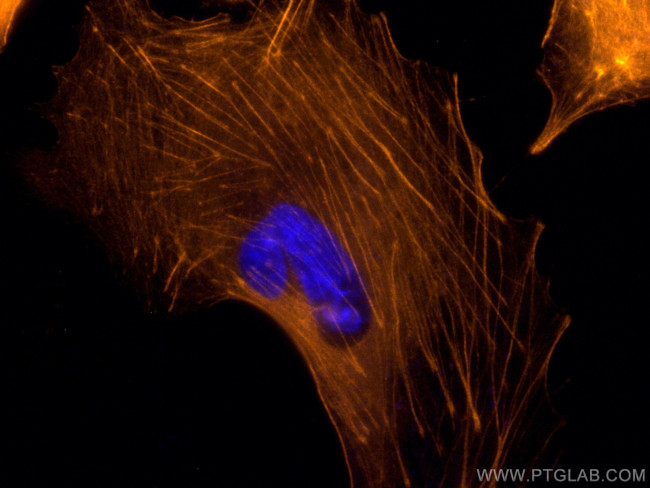 Beta Actin Antibody in Immunocytochemistry (ICC/IF)