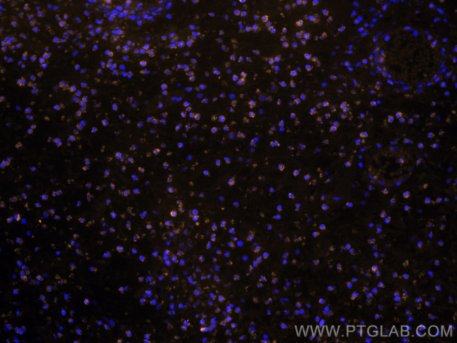 BCL2 Antibody in Immunohistochemistry (PFA fixed) (IHC (PFA))