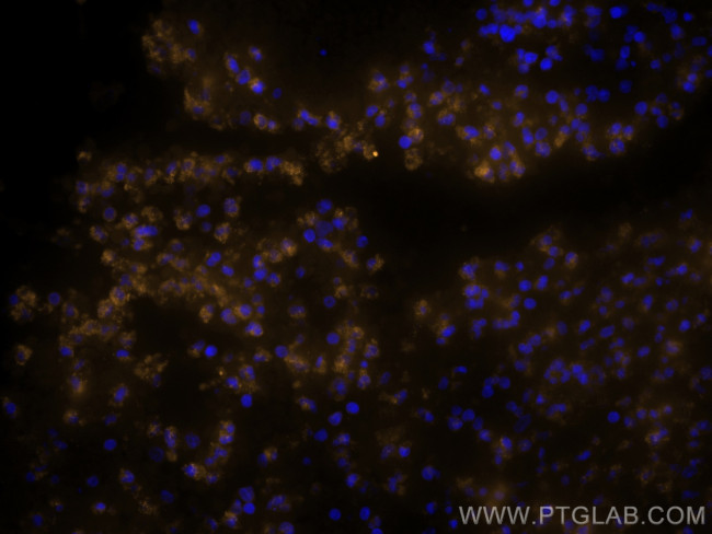 BCL2 Antibody in Immunohistochemistry (PFA fixed) (IHC (PFA))