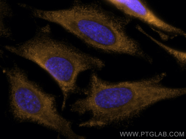 CDK6 Antibody in Immunocytochemistry (ICC/IF)