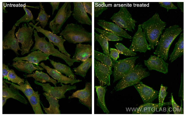 G3BP1 Antibody in Immunocytochemistry (ICC/IF)