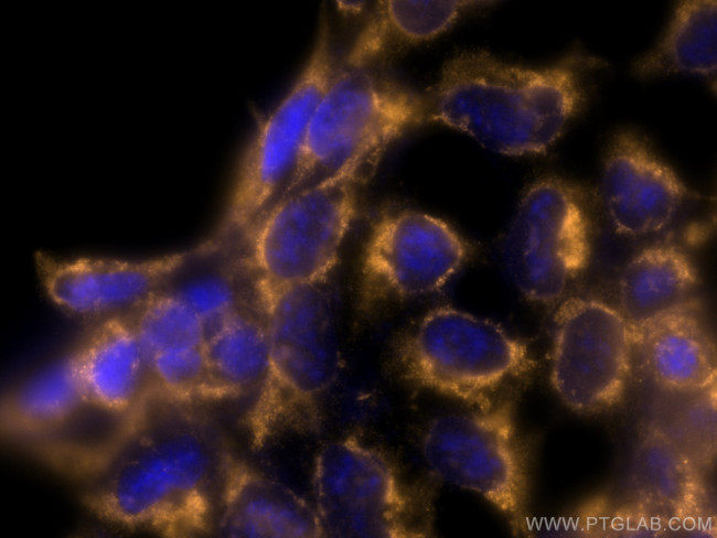 TPT1 Antibody in Immunocytochemistry (ICC/IF)