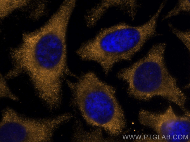 PCK1 Antibody in Immunocytochemistry (ICC/IF)