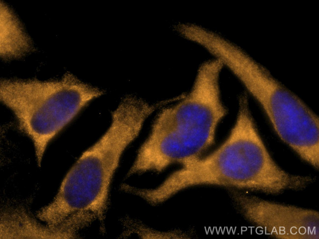 ACC1 Antibody in Immunocytochemistry (ICC/IF)