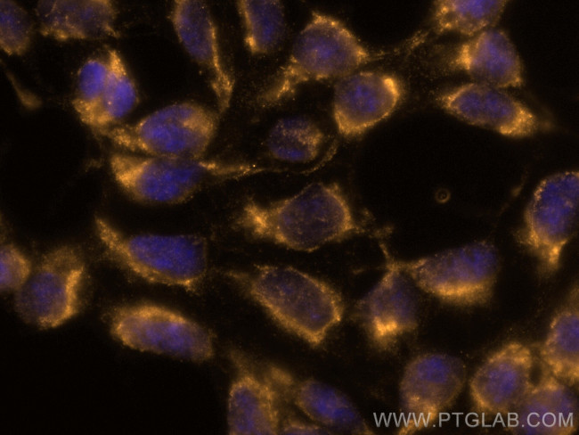 VPS53 Antibody in Immunocytochemistry (ICC/IF)